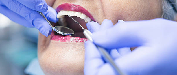 Best Emergency Dentist for Knocked-Out Tooth in Lake Goodwin, WA
